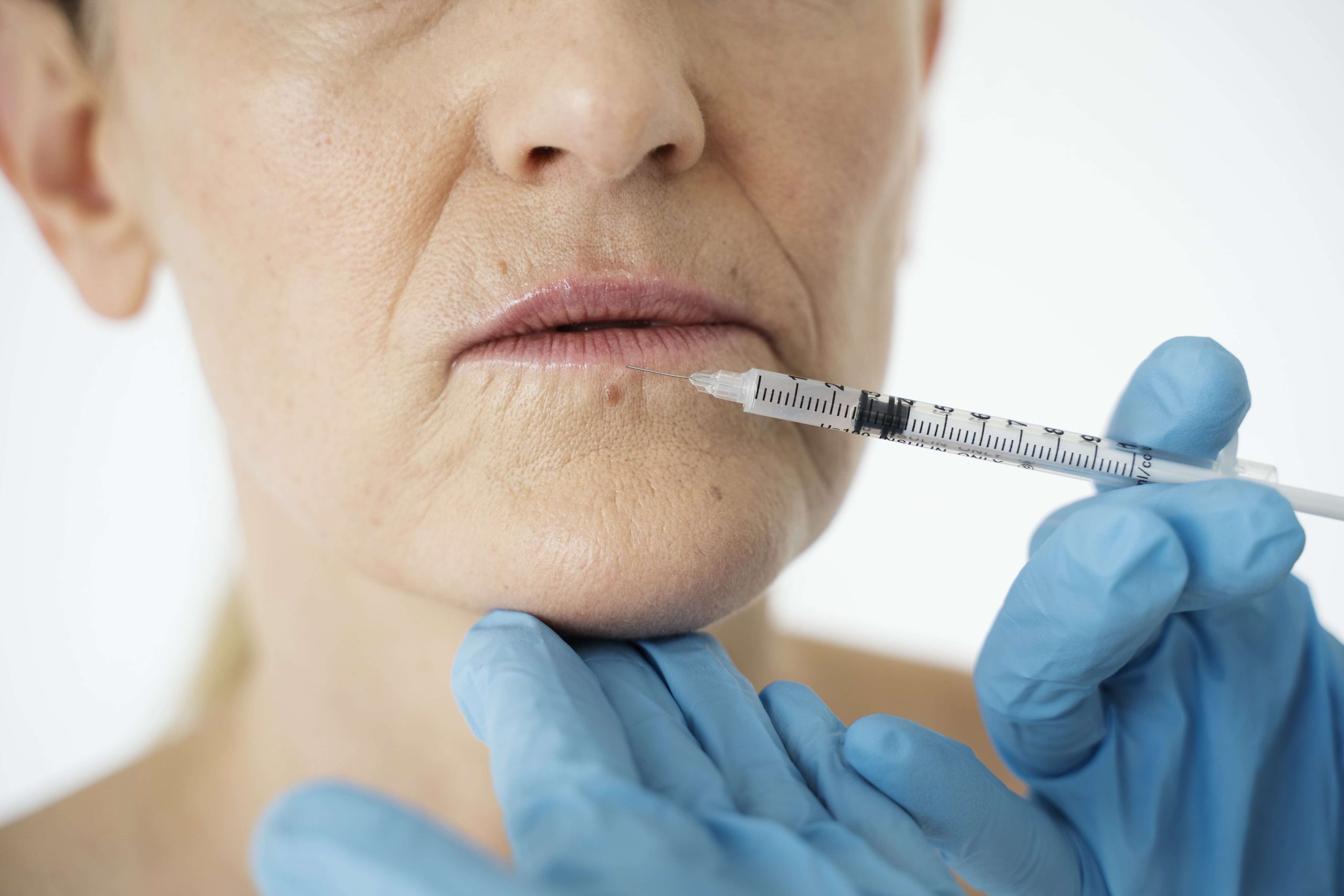 dr-dali-acid-injectari Injectări cu acid hialuronic