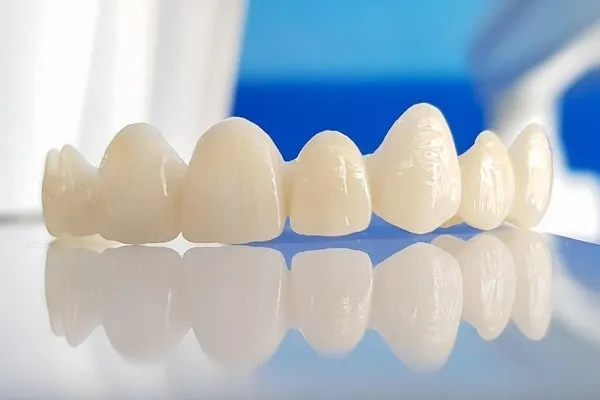 Lucrare-dentara-de-zirconiu.jpg Stomatologie