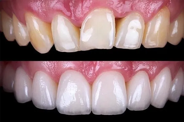 fatete-dentare.jpg Stomatologie