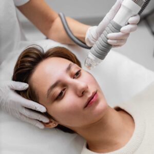 microneedling-bucuresti-dr-dali Microneedling