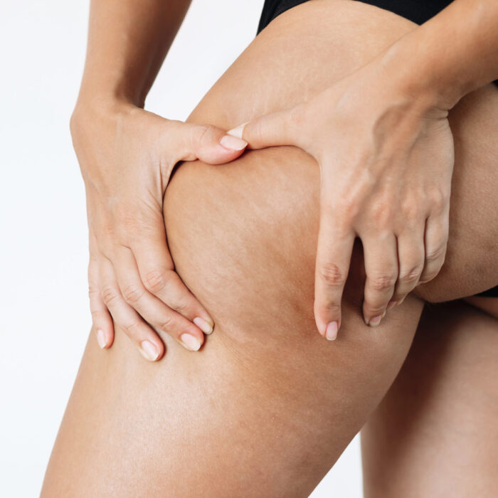 Acasă featured_image